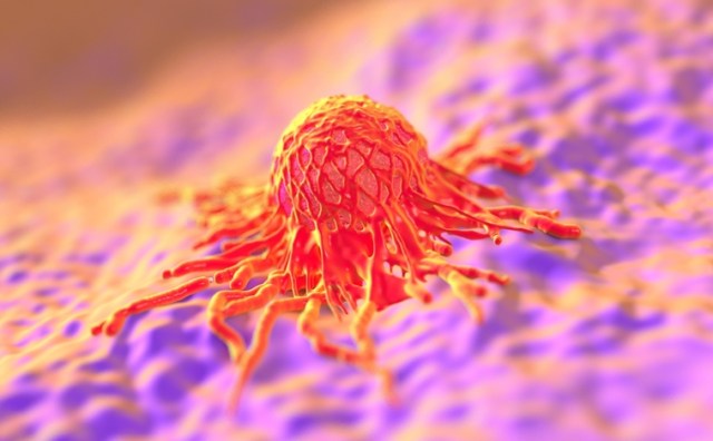 Clipping Digital | Higienista Jose Carlos Grimberg Blum// El excepcional caso de una mujer que ha sobrevivido a 12 tumores abre una vía para curar el cáncer